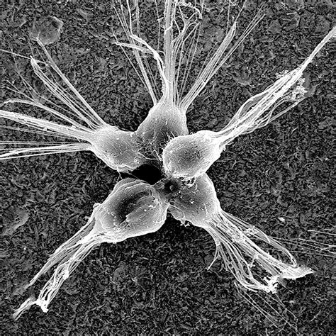 Virus Under Electron Microscope