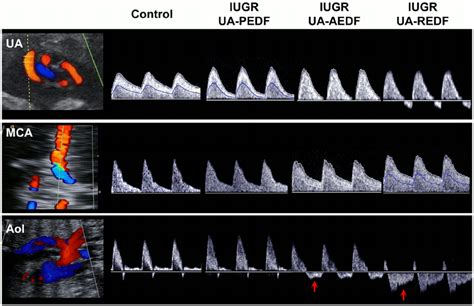 Doppler ultrasound data of the study individuals. Doppler recordings ...