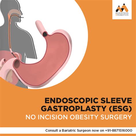 ESG is a non-surgical weight loss procedure that works by reducing the space inside your stomach ...