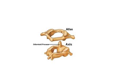 Axis is different from atlas in