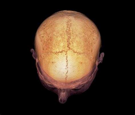 Skull Sutures Photograph by Science Photo Library - Pixels