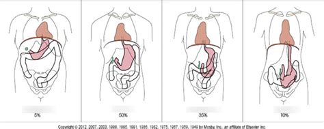 Body Habitus Diagram | Quizlet