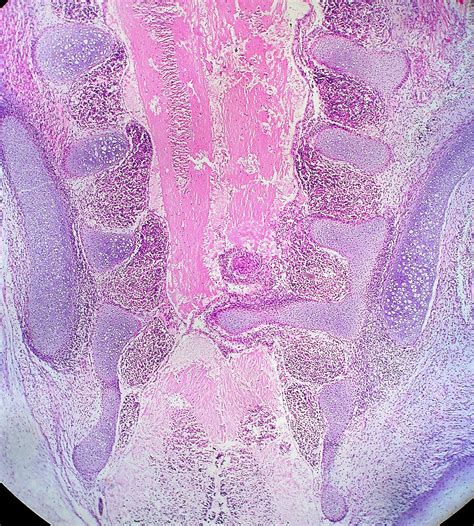 Pelvis and Lower Spine of Human Embryo | The pelvic bones ar… | Flickr