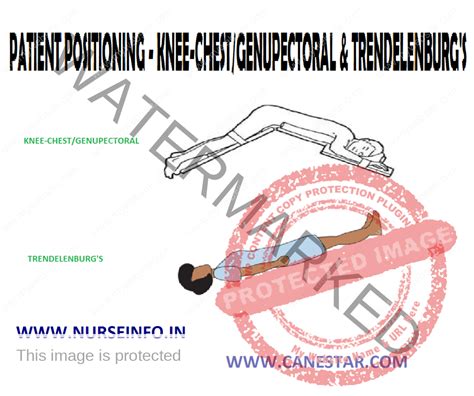 PATIENT POSITIONING – KNEE-CHEST/GENUPECTORAL & TRENDELENBURG’S ...