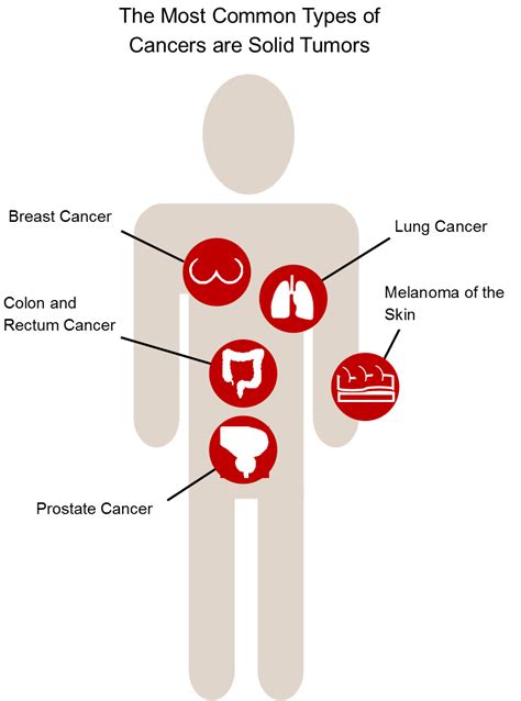 Tumor Pressure