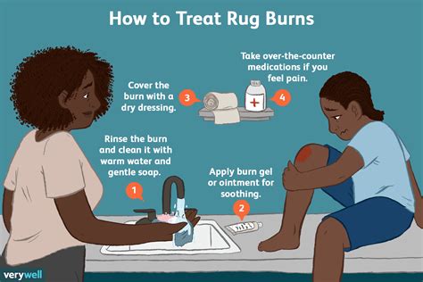 The Best 20 Pics How To Treat A Rug Burn On Your Face And View | Burns ...