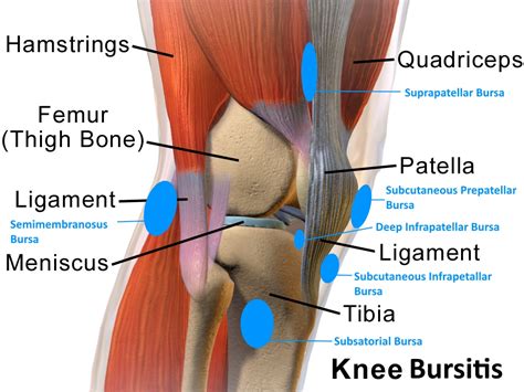 Knee Bursitis in Runners