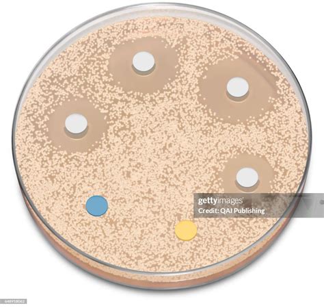 Bacterial culture, A bacterial culture is a laboratory technique that ...