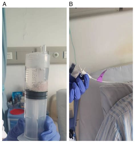 (A) Image showing lorlatinib being dissolved in a syringe. (B) Image ...