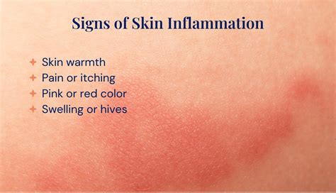 What is Skin Inflammation | Is There a Cure? – Skin Type Solutions