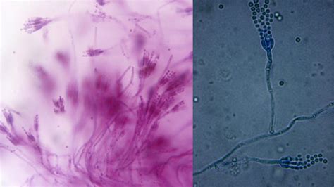 Chromatin Under Microscope
