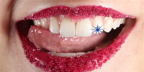 Diamond on teeth-Sparkle your smile with Teeth Jewellery - Sanjivani Dental Clinic