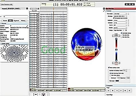 below shows the alpha waves produced from the experiment. Alpha waves ...