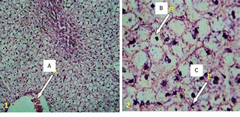 Group (1) shows (A) congestion of the central vein with erythrocytes... | Download Scientific ...