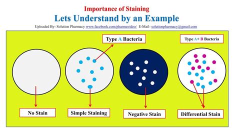 Microbial Staining= Simple Staining | Gram Staining | Acid Fast Staining | Staining Technique ...