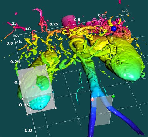 4D volume visualization for medical imaging