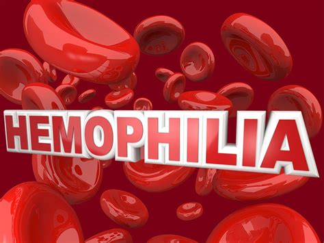 FDA Approves Idelvion for Hemophilia B