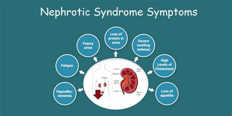 Is nephrotic syndrome in adults often associated with a systemic disease such as diabetes ...