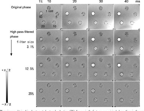 Figure 1 from Artifact reduction of susceptibility-weighted imaging ...