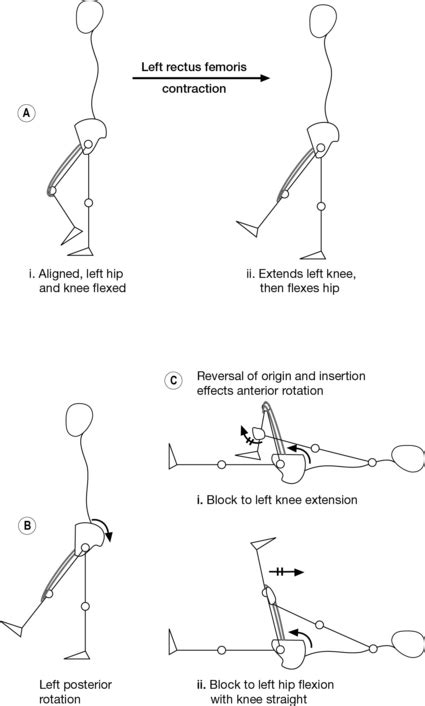 A comprehensive treatment approach | Musculoskeletal Key