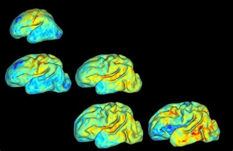 3D Mapping Babies' Brains - Neuroscience News