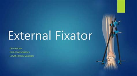 External fixator | PPT