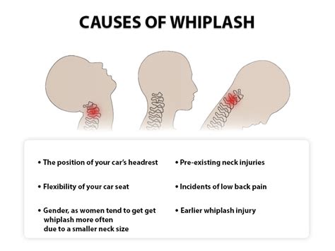 Neck Injury/Whiplash Doctors NJ & NYC