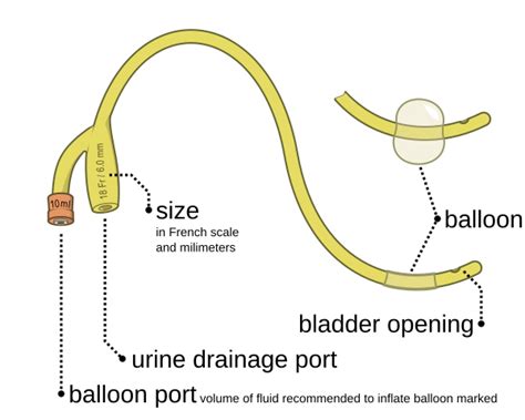 File:Foley catheter inflated and deflated EN.svg - Wikimedia Commons