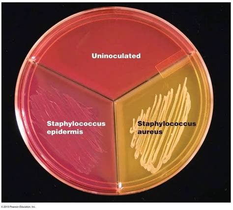 Mannitol Salt Agar: Principle, Uses, and Results – Microbe Online