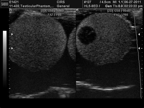 Scrotal Ultrasound Training Phantom - CIRS