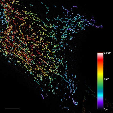 Live Cell Imaging with ZEISS Microscope Systems