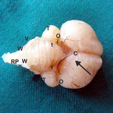 Dorsal view of the ostrich brain, 36 th embrionic day: cerebral... | Download Scientific Diagram