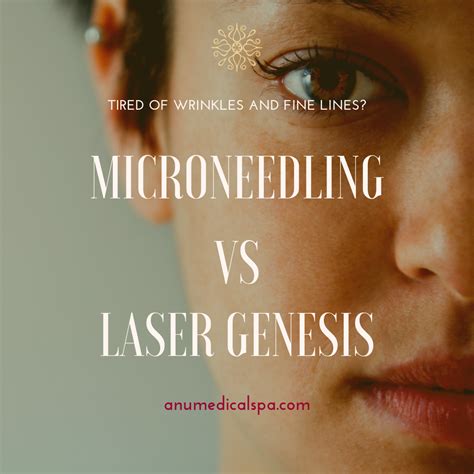 Microneedling vs. Laser Genesis | ANU Medical Spa | Voorhees, NJ