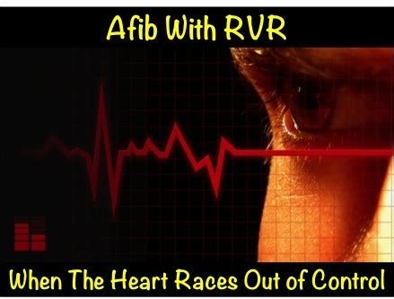 Afib with RVR: Most Important Info • MyHeart