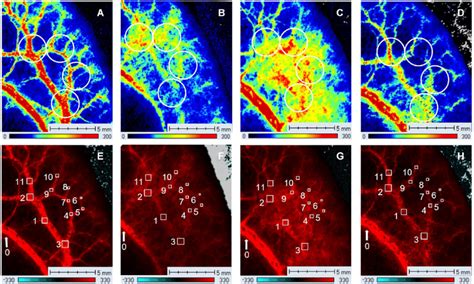 The perfusion maps showing treatment effect of PUT. (A) The perfusion... | Download Scientific ...