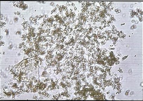 VETT 4 Urinalysis - Sediment Flashcards | Quizlet