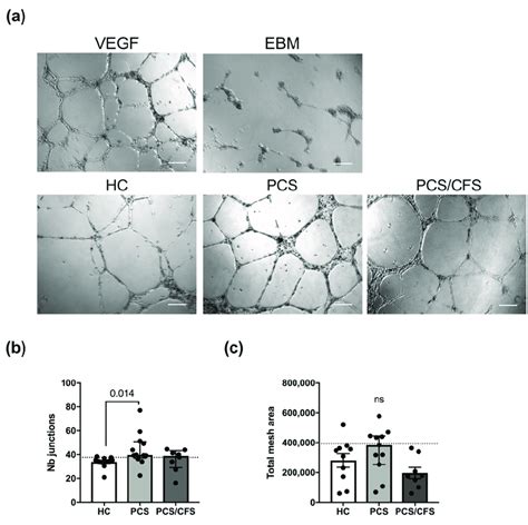 In vitro angiogenesis assay for serum-treated cultured human ...