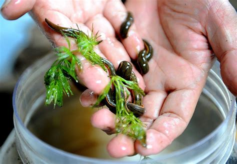 What is leech therapy? The healing power of medicinal leeches | Metro News