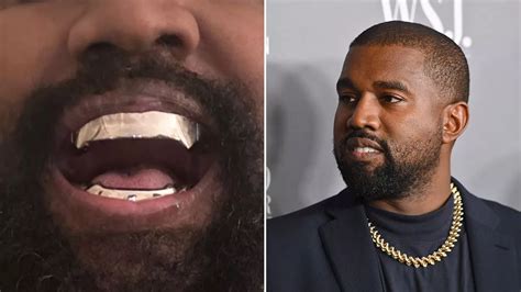 Kanye West shocks fans as he has teeth replaced with bizarre £670,000 titanium grill - Mirror Online