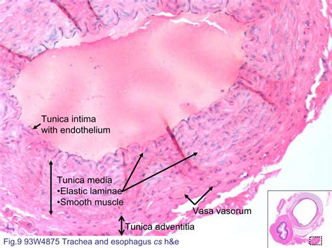 Block3/Fig.9 93W4875 Trachea and esophagus cs h&e.