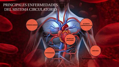 PRINCIPALES ENFERMEDADES SISTEMA CIRCULATORIO by LAURY VANESSA MARIN ...