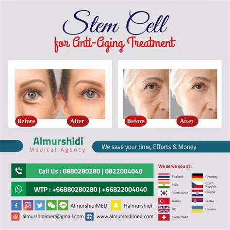 Stem Cell Treatment for Anti-Aging (Facial Rejuvenation) in Bangkok, Thailand - Almurshidi ...