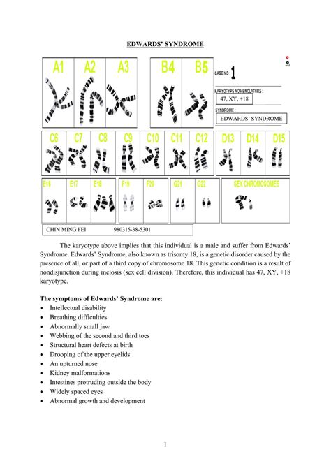 Human Karyotype Analysis | BOI116 - Genetics - USM | Thinkswap