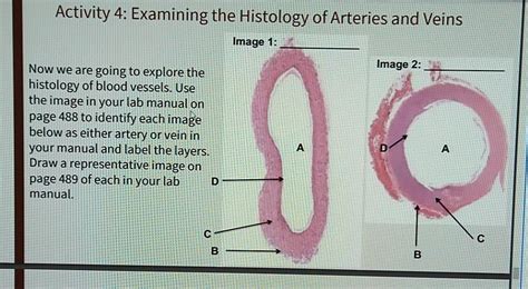 Solved Activity 4: Examining the Histology of Arteries and | Chegg.com