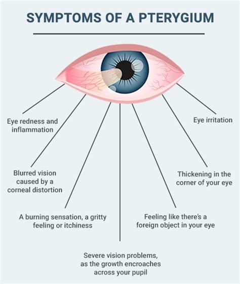 Pterygium Treatment & Removal in NYC - Award Winning Eye Doctors