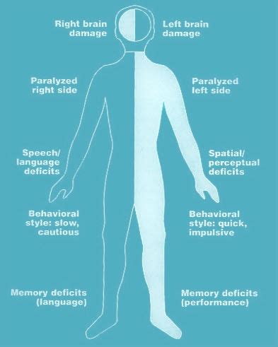 Hemiplegia vs Hemiparesis