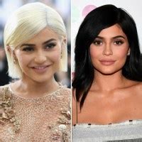 Kylie Jenner's Smile Makes Her Unrecognizable — Plus More Stars