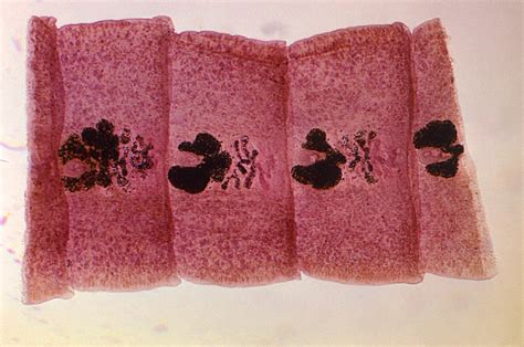 Public Domain Picture | Gravid proglottids of Diphyllobothrium latum ...