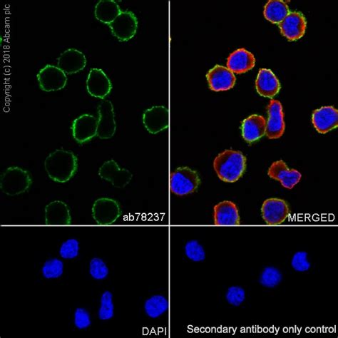 Recombinant Anti-CD20 antibody [EP459Y] KO Tested (ab78237) | Abcam