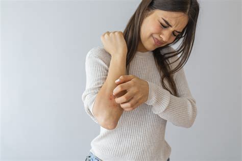 How to Tell the Difference Between Shingles and Other Rashes